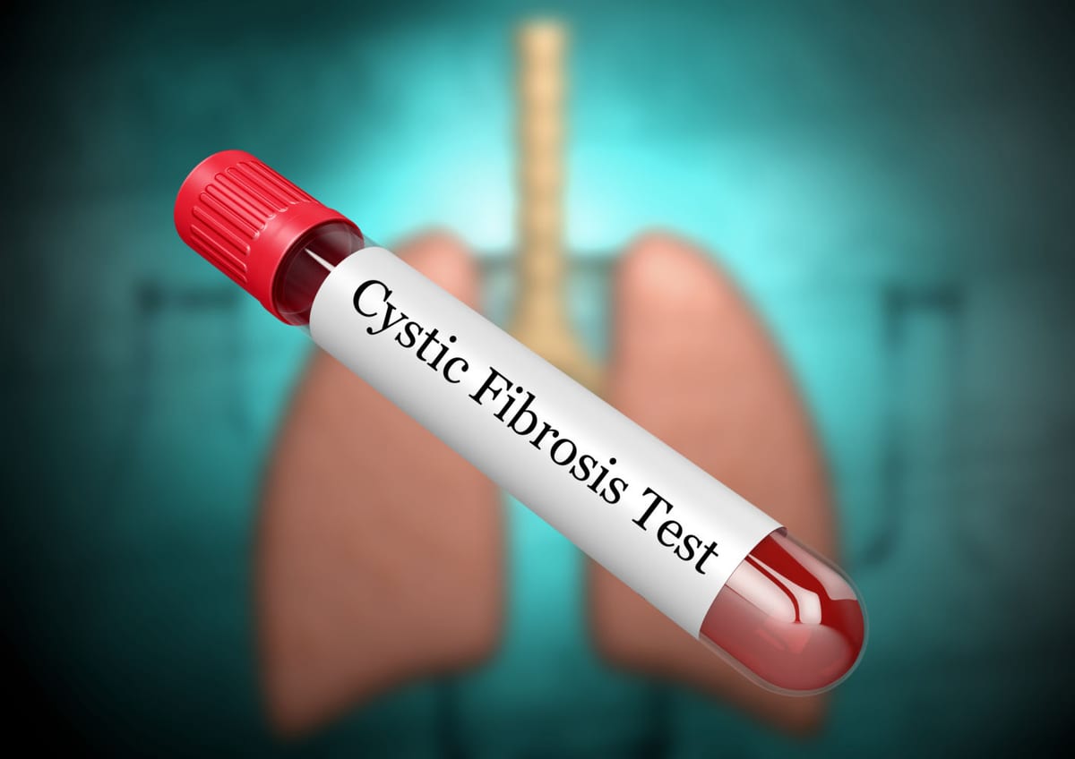 Test genetico fibrosi cistica